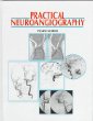 Practical Neuroangiography