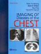 Imaging of Diseases of the Chest