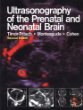 Ultrasonography of the Prenatal & Neonatal Brain
