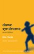 Down Syndrome: the Facts