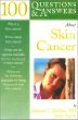 100 Questions and Answers about Melanoma & Other Skin Cancers