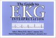 The Guide to Ekg Interpretation (White Coat Pocket Guide Series)